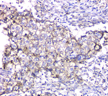 TIMM17A Antibody