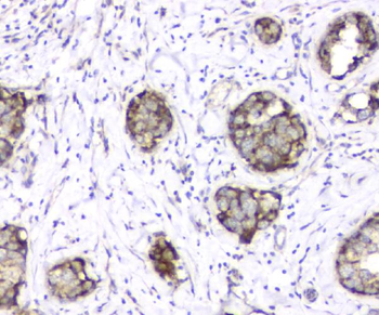 TIMM17A Antibody