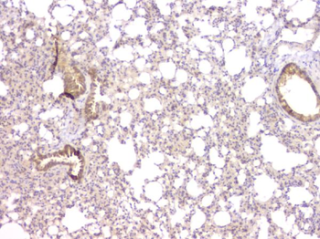 TIMM17A Antibody