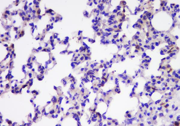 TIMM17A Antibody