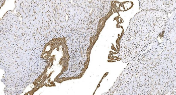 WEE1 Rabbit Polyclonal Antibody