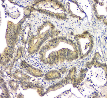 EIF6 Mouse Monoclonal Antibody