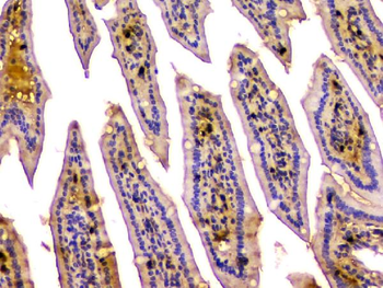 CA2 Mouse Monoclonal Antibody