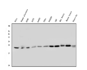 Rab5/RAB5A Mouse Monoclonal Antibody