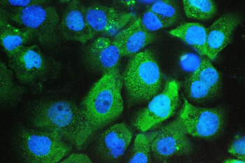 Galectin 3/LGALS3 Antibody (monoclonal, 12B12)