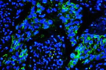 Caveolin-1/CAV1 Antibody (monoclonal, 12C7)