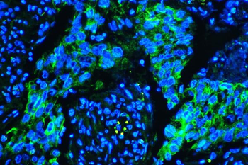Caveolin-1/CAV1 Antibody (monoclonal, 12C7)