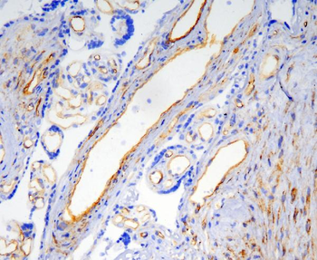 Caveolin-1/CAV1 Antibody (monoclonal, 12C7)