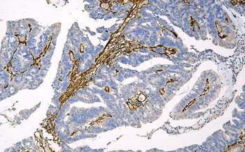Caveolin-1/CAV1 Antibody (monoclonal, 12C7)
