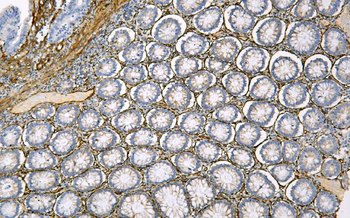 Caveolin-1/CAV1 Antibody (monoclonal, 12C7)