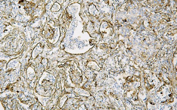 Caveolin-1/CAV1 Antibody (monoclonal, 12C7)