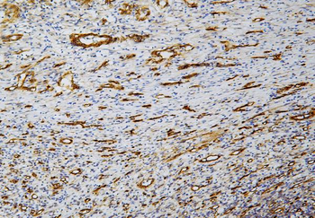 Caveolin-1/CAV1 Antibody (monoclonal, 12C7)