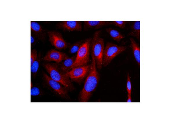 Cytokeratin 8 KRT8 Antibody (monoclonal, 3G9)