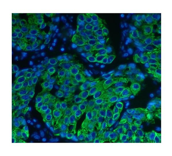 Cytokeratin 8 KRT8 Antibody (monoclonal, 3G9)