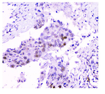 HAUSP/USP7 Antibody (monoclonal, 5E2)