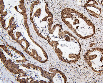 MECP2 Rabbit Polyclonal Antibody