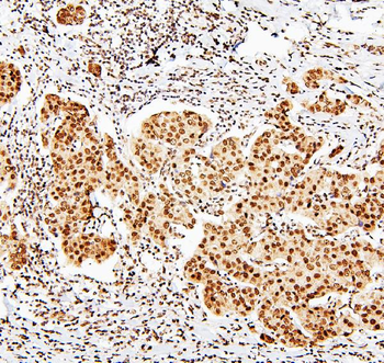 MECP2 Rabbit Polyclonal Antibody