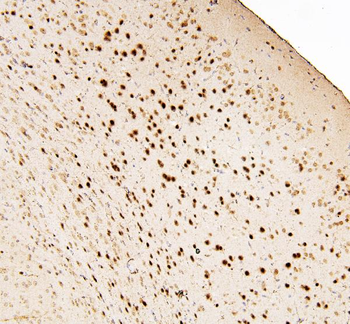 MECP2 Rabbit Polyclonal Antibody