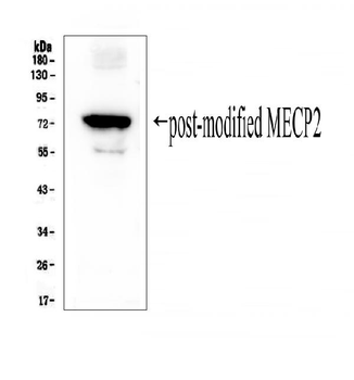 MECP2 Rabbit Polyclonal Antibody