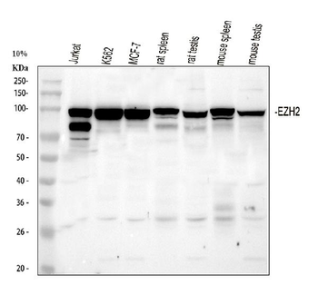 KMT6/EZH2 Rabbit Polyclonal Antibody