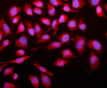 SMAD2 Rabbit Polyclonal Antibody