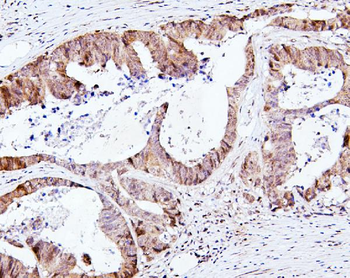 SMAD2 Rabbit Polyclonal Antibody