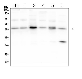 SMAD2 Rabbit Polyclonal Antibody
