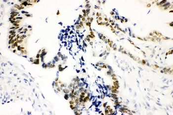 SOX9 Antibody