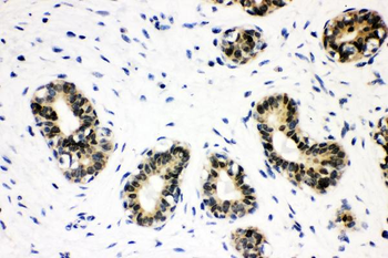 SOX9 Antibody