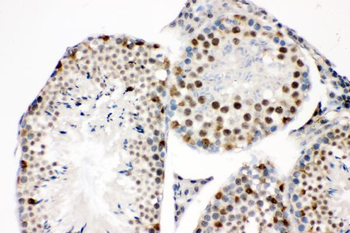 SOX9 Antibody