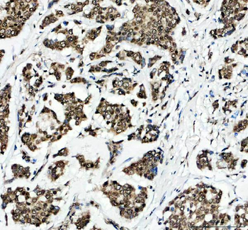 Histone H2A.X/H2AFX/H2A Rabbit Polyclonal Antibody