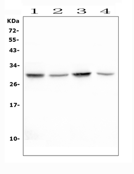Erythropoietin EPO Rabbit Polyclonal Antibody