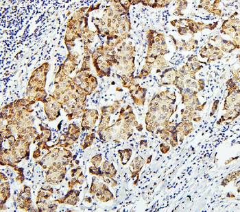 Zinc finger protein GLI2 GLI2 Rabbit Polyclonal Antibody