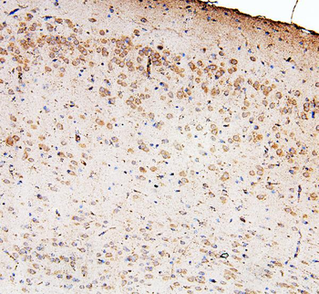 Zinc finger protein GLI2 GLI2 Rabbit Polyclonal Antibody