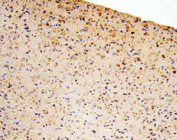 Zinc finger protein GLI2 GLI2 Rabbit Polyclonal Antibody