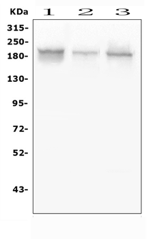 Zinc finger protein GLI2 GLI2 Rabbit Polyclonal Antibody
