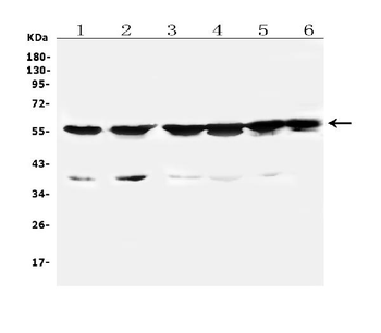 Cytochrome P450 2B6/CYP2B6 Rabbit Polyclonal Antibody
