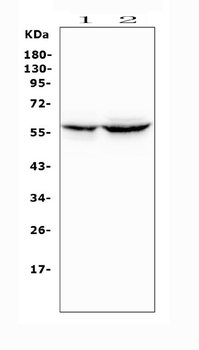 Cytochrome P450 2A6/CYP2A6 Rabbit Polyclonal Antibody