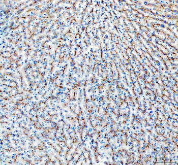 MRP2/ABCC2 Rabbit Polyclonal Antibody