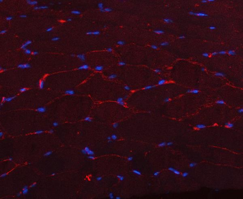 Caveolin-3/CAV3 Rabbit Polyclonal Antibody