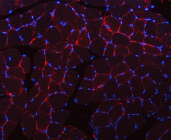 Caveolin-3/CAV3 Rabbit Polyclonal Antibody