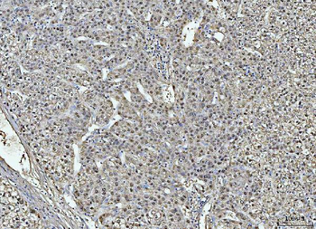 liver Arginase/ARG1 Antibody