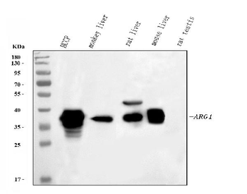 liver Arginase/ARG1 Antibody