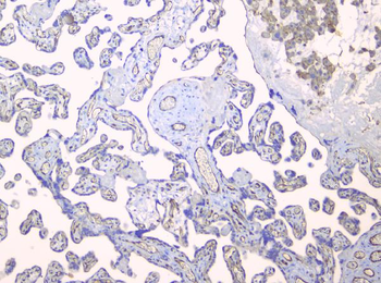 TIE2/TEK Antibody