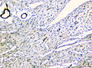 TIE2/TEK Antibody