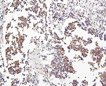 CRB1 Rabbit Polyclonal Antibody