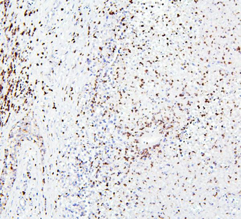 CRB1 Rabbit Polyclonal Antibody