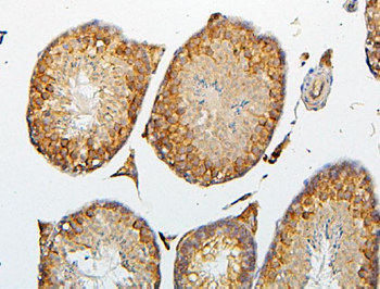 CRB1 Rabbit Polyclonal Antibody