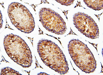 CRB1 Rabbit Polyclonal Antibody