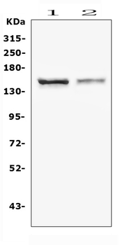 CRB1 Rabbit Polyclonal Antibody